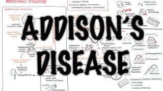 Addisons Disease  Overview clinical features pathophysiology investigations treatment [upl. by Eisned]