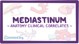 Anatomy clinical correlates Mediastinum [upl. by Brenner357]