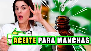 Utiliza este ACEITE para Aclarar cualquier MANCHA EN la Piel incluido el Melasma [upl. by Tuppeny]