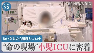 「さすってもさすっても冷たくて…」幼い女児の心臓蝕むコロナ “小児ICU” 最重症の子どもたち救う命の現場に密着【news23】｜TBS NEWS DIG [upl. by Aidekal887]