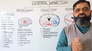 Stroke UrduHindi medium profmasoodfuzail Cerebral Infarction  Types of Stroke  Brain Stoke [upl. by Malha551]