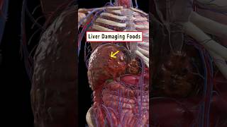 5 Foods Damaging Your Liver ☠️  health liver wellness healthtips shorts [upl. by Valera]