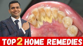 Top 2 Remedies To Remove Dental Plaque  Remove Dental Plaque and keep Oral Hygiene Healthy At Home [upl. by Nylde]