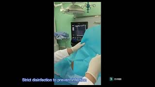 Ultrasoundguided approach for puncturing dorsal root ganglion – Video abstract 479986 [upl. by Nuahsed]