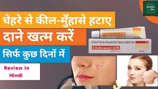 Neoclobenate Gm Cream Review in Hindi । HealthyBro। [upl. by Oberg]