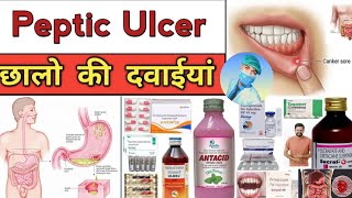 peptic ulcer। stomach ulcer। medical knowledge। medical treatment। pharmacy knowledge [upl. by Ordnasil]