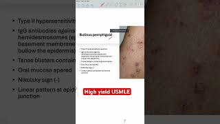 Bullous pemphigoid usmle usmlepreparation usmlestep1videos [upl. by Kunz]