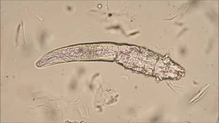 Demodex canis mites [upl. by Aivataj]