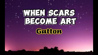 When Scars Become Art [upl. by Leventhal]