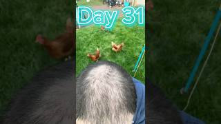 Day 31 Join My Hair Transplant Journey Real Results amp Recovery Day [upl. by Annoyek]