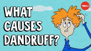 What causes dandruff and how do you get rid of it  Thomas L Dawson [upl. by Alrats352]