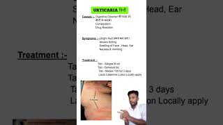 Urticaria  पित्ती causes symptoms and treatment [upl. by Templas108]