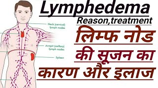 चर्बी की गांठ बनती क्यों हैं कारण क्या हैउपाय क्या करें इलाज क्या है Treatment of Lipomas [upl. by Laura]