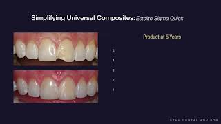 Simplifying Composite Restorations  Estelite Sigma Quick [upl. by Einahpetse]