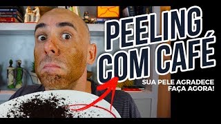 PEELING CASEIRO PARA TIRAR MANCHAS DO ROSTO  Dr Dayan Siebra [upl. by Bully]