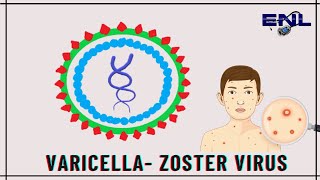 Varicella Zoster Virus  Microbiology  Explanation in Hindi [upl. by Reh]