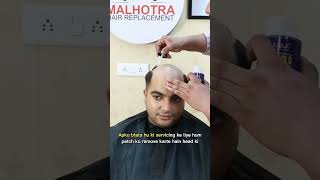 Hair patch service Hair loss treatment for men [upl. by Ymerej]