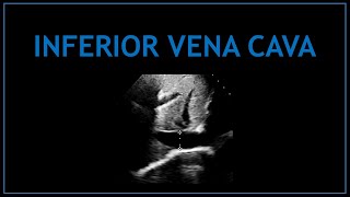 Inferior Vena Cava IVC Echocardiography [upl. by Phail595]