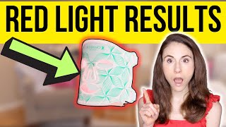 DO LED LIGHT MASKS REALLY WORK  Dermatologist reviews Omnilux [upl. by Aidualk]