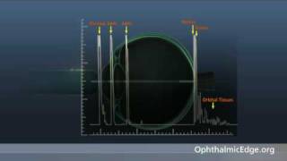 Lecture 4How Does an AScan Become a BScan [upl. by Aratal]