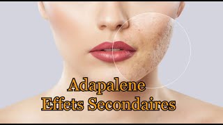 Adapalene Effets secondaires [upl. by Ennayar]