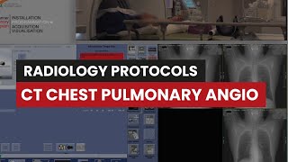 Pulmonary Angiography CT Protocol A Guide for Rad Techs [upl. by Appleton315]