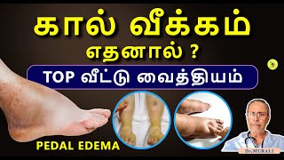 கால் வீக்கம் ஆபத்தாபோக்க என்ன வழி வீட்டு வைத்தியம்  PEDAL EDEMA [upl. by Tini]