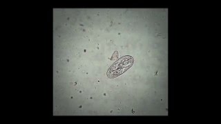 A Strongyloides spp egg in the faeces of cattle [upl. by Badr]