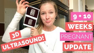 9  10 Week Pregnancy Update  3D ULTRASOUND [upl. by Kaufmann613]