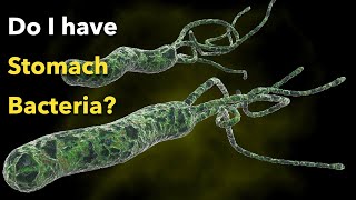 Do I need to treat the stomach bacteria Helicobacter Pylori [upl. by Ettezzil]