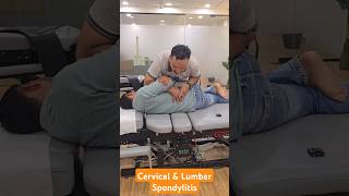 Cervical and Lumbar Spondylitis Treatment in India DrMushtaque 🇮🇳 chiropractor Migren sciatica [upl. by Tirrag]