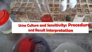 Urine Culture and Sensitivity Procedure and Result Interpretation [upl. by Rodriguez]