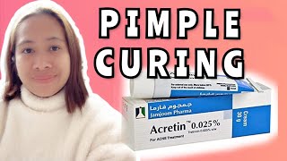 ACRETIN GAMOT SA MAY MGA PIMPLES MURA AT EPEKTIBO PA KSA RIYADH [upl. by Nyrahtak]