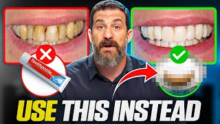 Neuroscientist quotToothpaste Is Damaging Your Teethquot How To Take Care of Your Teeth [upl. by Avlis26]