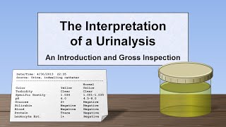 Interpretation of the Urinalysis Part 1  Introduction and Inspection [upl. by Rorrys]