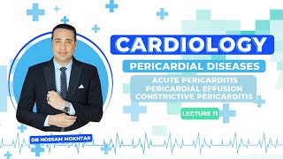 Cardiology ll Pericardial Diseases ll  Acute pericarditis amp Pericardial effusion amp CP [upl. by Halyahs926]