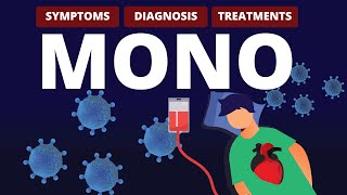 What is MONO Symptoms Diagnosis amp Treatments [upl. by Oilerua327]