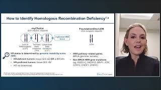 Personalizing Advanced Ovarian Cancer Treatment With PARP Inhibitors and Novel Approaches [upl. by Cherri]