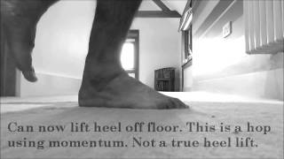 Achilles Tendon Rupture Recovery  Week 19  Heel Raise Update [upl. by Hoo734]