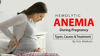 Hemolytic Anemia during Pregnancy  Full Explanation in Hindi  By NG Medicals [upl. by Akeemahs]