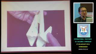 Dr James Hui Triplane and Tillaux Ankle Fractures [upl. by Sanfred567]