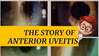 The story of ANTERIOR UVEITIS  iritis cyclitis and iridocyclitis  Signs amp symptoms and more [upl. by Herbie]