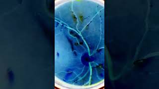 Normal fundus  Normal Retina  Smartphone Fundus Videography  Fundus Photography  Short Video 205 [upl. by Odrawde]