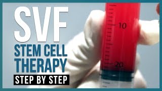 Stromal Vascular Fraction Stem Cell Therapy SVF Therapy  StepbyStep [upl. by Baptlsta]