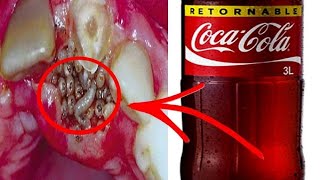 🤧 10 Enfermedades Que Le Pasa A Tu Cuerpo Al Tomar Coca Cola [upl. by Plusch]