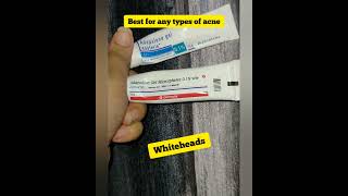 shorts Benefits of Adapalene gel 01 Differin gel for acne adapalene differingel [upl. by Leiand338]