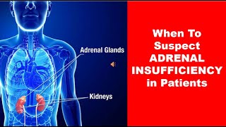 When To Suspect ADRENAL INSUFFICIENCY in Patients [upl. by Ennairol390]