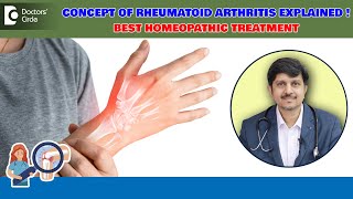 Rheumatoid Arthritis RA Factor controlled by Homeopathy Dr Sanjay Panicker  Doctors Circle [upl. by Yovonnda705]