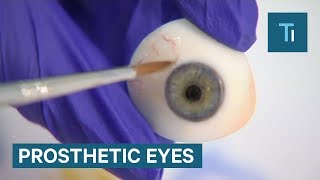 How Prosthetic Eyes Are Made And Fitted [upl. by Nahsez]