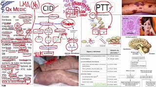 CID PTT [upl. by Ennove]